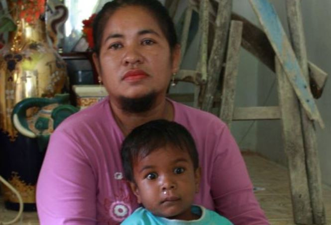 Explicatia medicilor in cazul femeii cu barba care a purtat de rusine un voal timp de 13 ani