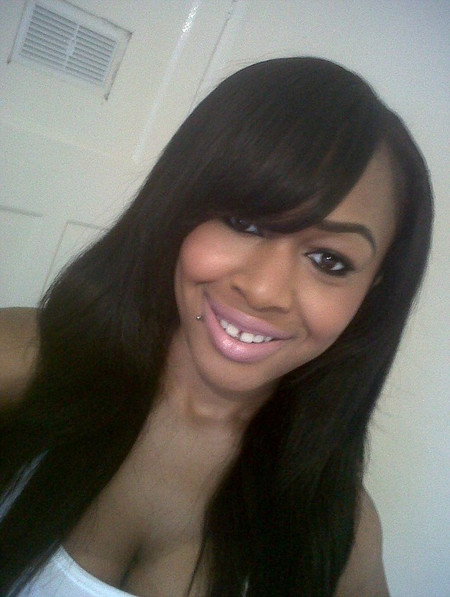 "Sunt fericita". Motivul banal pentru care o tanara cu chipul desfigurat de acid zambeste din nou