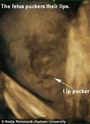 Imagini uimitoare surprinse la ecograf. Ce au vazut medicii cand s-au uitat la acesti bebelusi