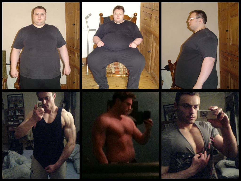 Acum un an si jumatate a vrut sa se sinucida din cauza felului in care arata. "Provocam greata"