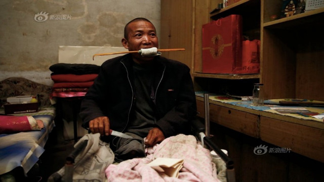 Un barbat si-a taiat singur piciorul infectat, pentru ca nu avea bani pentru tratament