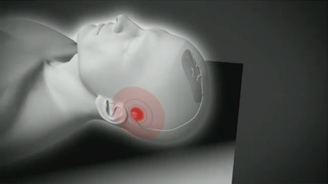 Proiectul SF al guvernului american. De ce vrea sa implanteze un cip in creierul soldatilor