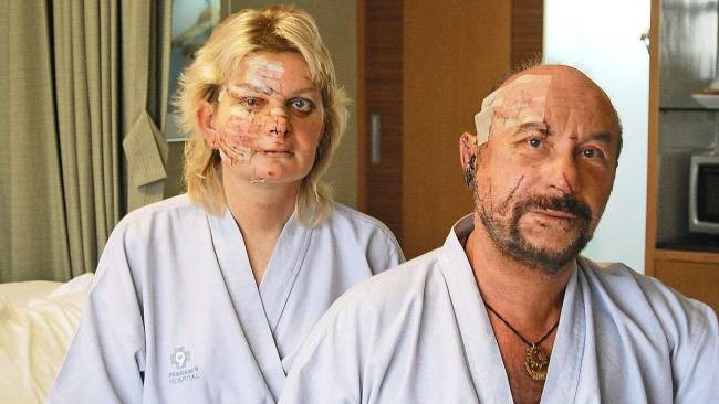 Cum arata doi turisti germani dupa ce au scapat din acest accident pe strazile din Bangkok