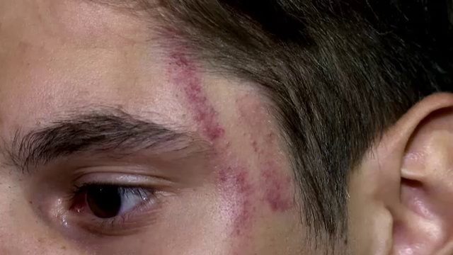 Jandarmii bucuresteni, acuzati de agresiune. "Mi-au dat cu pumnii si picioarele in cap"