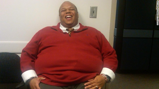 "A slabit echivalentul unui aragaz." Cum a ajuns in 2 ani barbatul din imagine