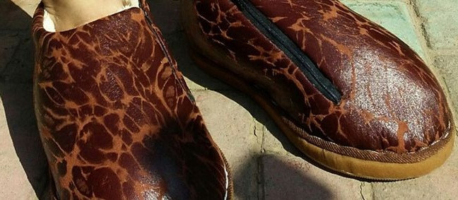 Povestea barbatului din China care sufera de elefantiazis. S-a incaltat prima data la 27 de ani