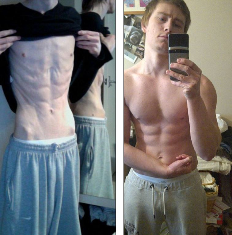 Manca doar o banana si un baton de cereale pe zi. A invins anorexia si a ajuns model