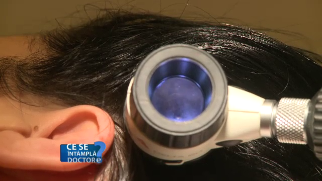 Ce fel de sampon trebuie sa folositi daca aveti parul gras. Sfaturile specialistilor