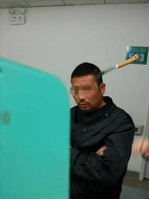 Barbat cu un cutit infipt in cap pozat in timp ce se plimba calm pe holul spitalului. GALERIE FOTO