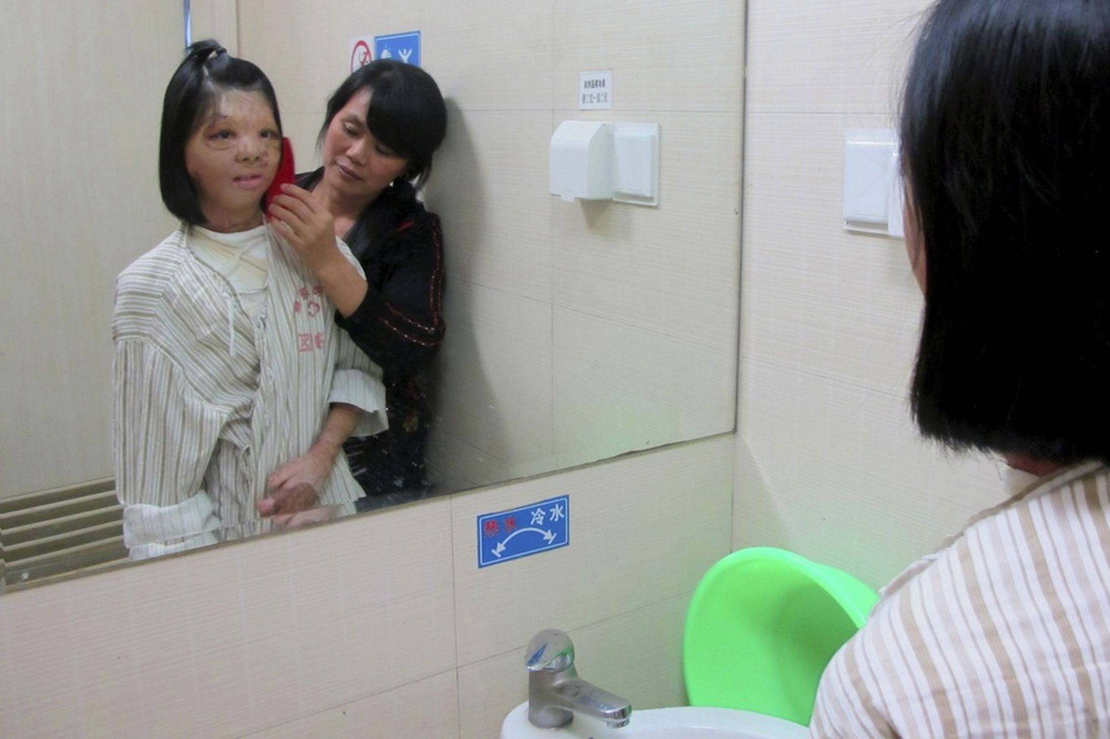 A reusit sa zambeasca dupa 12 ani. Medicii i-au crescut un chip nou pe unul din sani. VIDEO