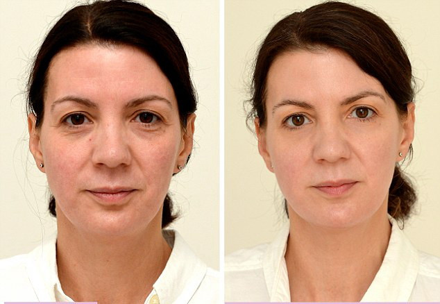 "M-a intinerit cu zece ani". Cum arata aceasta femeie, dupa ce a baut trei litri de apa pe zi. FOTO