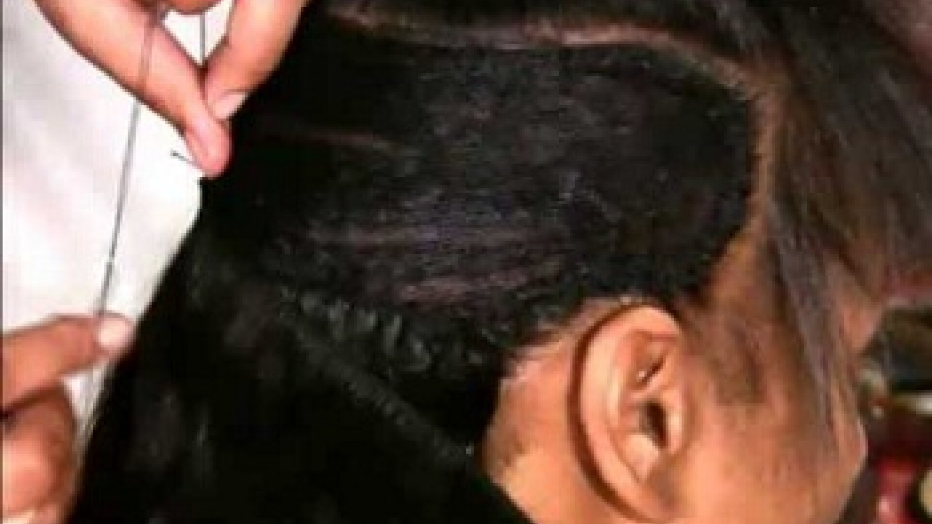 Si-a pus extensii de par la un salon. Ce s-a intamplat cu aceasta femeie dupa 2 saptamani