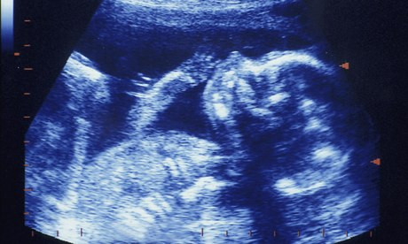 Medicii i-au spus ca a pierdut sarcina. Ce s-a intamplat cu aceasta femeie