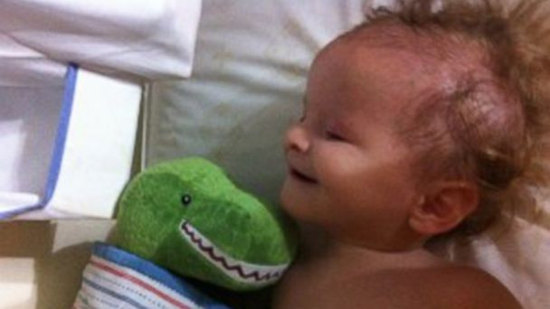 Povestea bebelusului nascut fara ochi, care a emotionat America