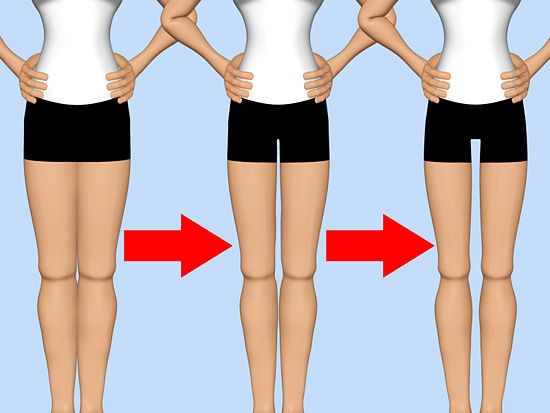 "Thigh Gap." Presiunea pusa asupra modului in care se vad femeile de o noua obsesie periculoasa