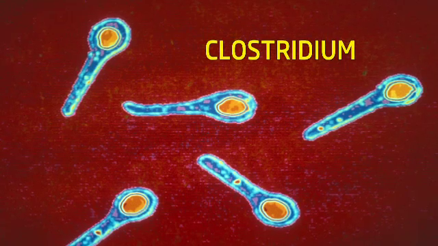 Masuri luate in toate spitalele din Romania din cauza bacteriei Clostridium. Cum se manifesta
