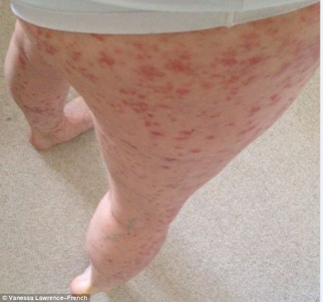 Vanessa Lawrence-French