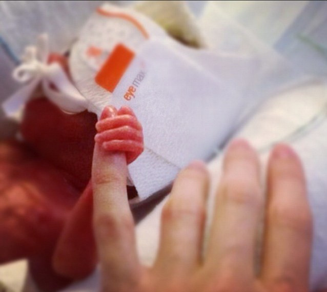 Copilul care avea la nastere doar 700 de grame si-a sarbatorit primul an de viata. Cum arata acum. FOTO