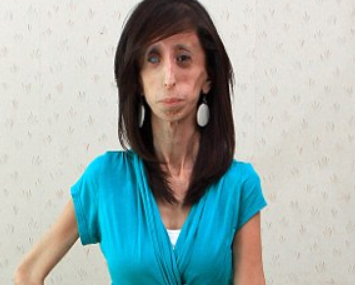 Lizzie Velasquez