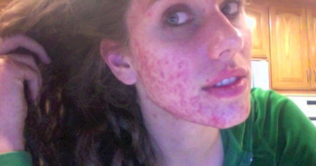 In urma cu doar cateva luni, ii era rusine sa iasa din casa, iar acum apare pe catwalk