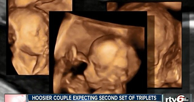 O femeie din SUA va da nastere la tripleti pentru a doua oara in mai putin de 24 de luni. FOTO