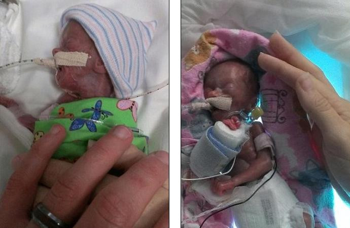 Era mai mica decat o doza de suc cand s-a nascut. Ce s-a intamplat cu fetita dupa 6 luni
