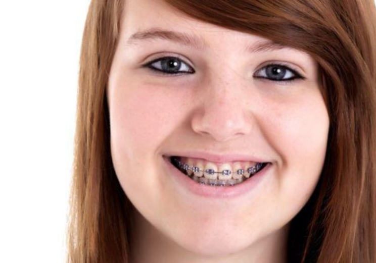 O adolescenta din Marea Britanie a murit de soc toxic dupa ce a folosit un tampon