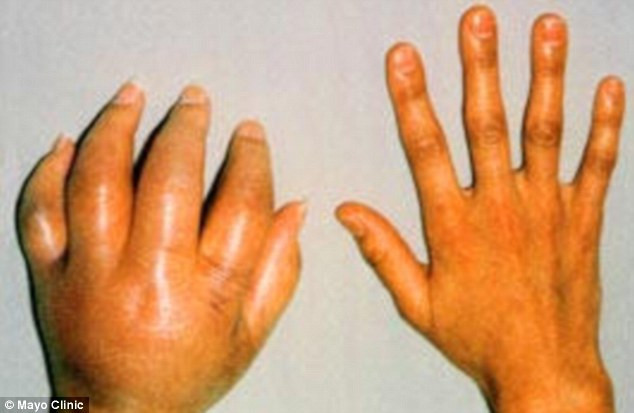 Cercetatorii sunt intrigati de o afectiune misterioasa, care provoca dureri extreme