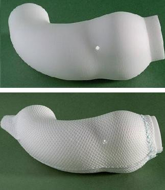 Un inginer britanic si-a proiectat propria proteza pentru afectiunea cardiaca de care suferea