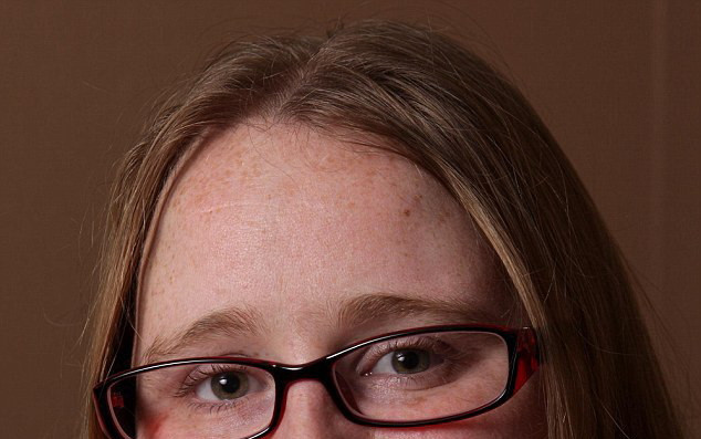 Are mustata si barba din cauza unei boli. Cum arata femeia dupa ce nu s-a barbierit o luna. FOTO