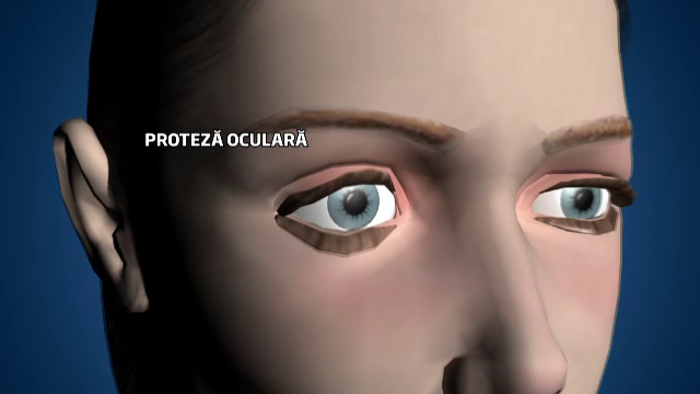 Procedura complicata prin care va fi reconstruit chipul tinerei impuscata in ochi in Bucuresti