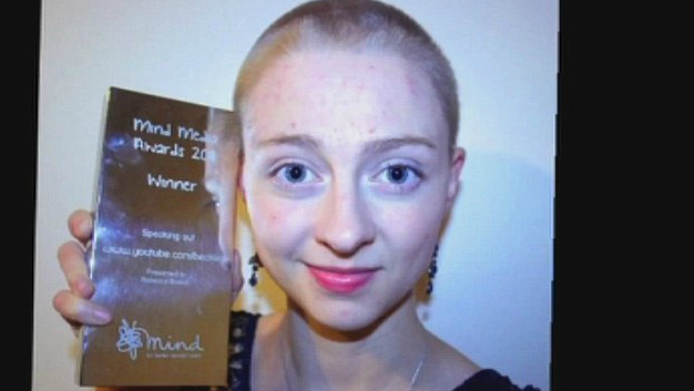 O tanara femeie din Anglia, care sufera de tricotilomanie, si-a smuls aproape tot parul din cap