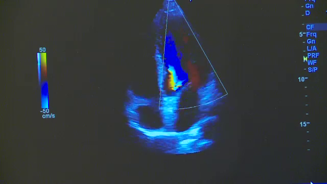 Eveniment caritabil in Bucuresti. Spitalul Marie Curie a primit un nou ecocardiograf