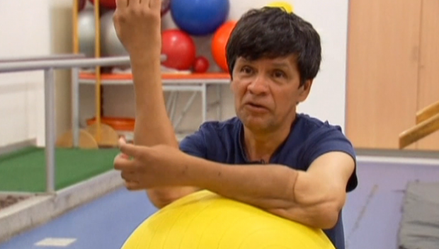 Un barbat din Mexic a suferit un dublu transplant de brate. Cum s-a intamplat totul. VIDEO