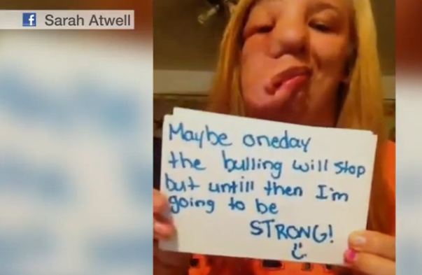 Adolescenta desfigurata de o tumoare a explicat lumii cum poate fi "salvata" intr-un documentar