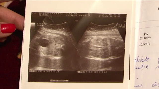 Esecul in lant al sistemului medical roman.Copil nascut cu malformatii,fara ca medicii sa realizeze