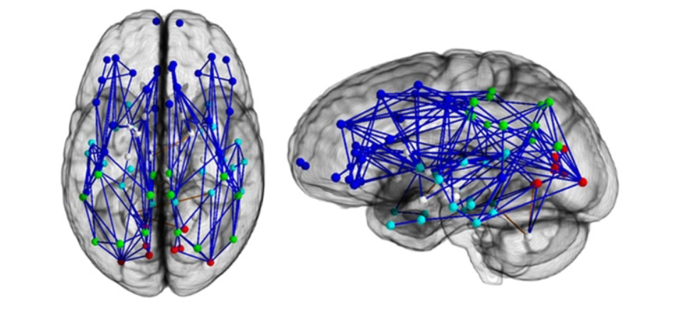 STUDIU. Diferentele dintre creierul femeilor si cel al barbatilor. La ce capitol sunt mai eficiente