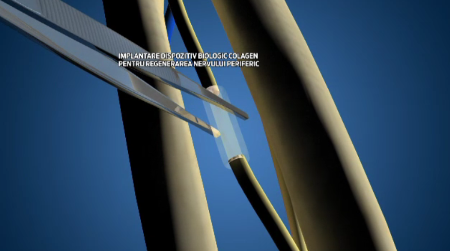 Inventia pentru care cercetatorii romani au primit aur la Bruxelles:solutia de regenerare a nervilor