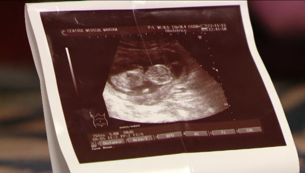 O femeie din Timisoara a aflat ca este gravida, la o luna dupa ce a fost la doctor pentru avort