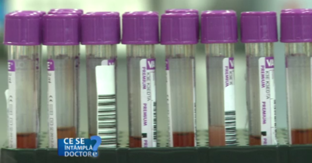 Testul de glicemie, esential in depistarea la timp a diabetului. Care sunt simptomele premergatoare