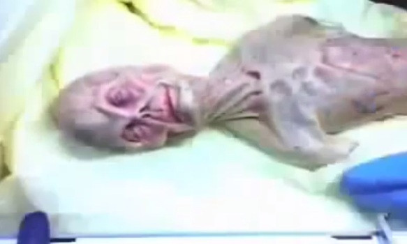 Vocea Rusiei aduce din nou in discutie presupusa autopsie a unui extraterestru din 1969