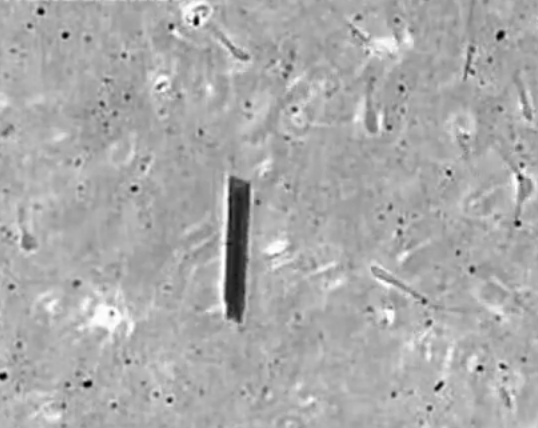 Spermatozoizi controlati de la distanta. Ei vor putea livra medicamente oriunde in organism