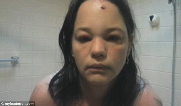 Atacata de motanul pe care l-a salvat de la eutanasiere. Femeia a ajuns la spital. VIDEO