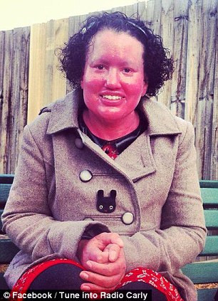 Au ras de ea pentru ca arata asa. Le-a parut rau cand au vazut raspunsul fetei