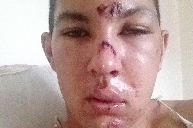 A vrut sa ii ia apararea unei femei, dar a fost batut crunt. Ce a patit un fotbalist englez