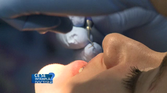 Mergeti si la dentist daca aveti dureri de cap. Ce probleme stomatologice pot provoca migrene