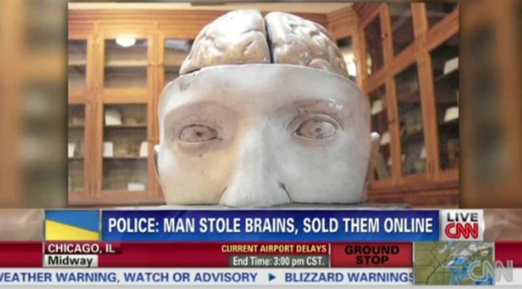 Incident neobisnuit in SUA. Un tanar a incercat sa faca bani vanzand recipiente cu creier uman