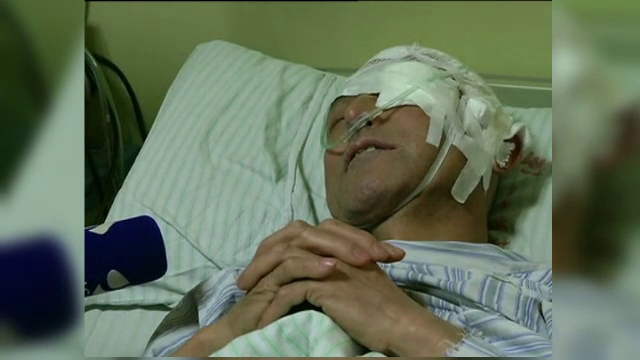 Un barbat din China a ajuns la spital cu un cui in cap. Ce au declarat medicii