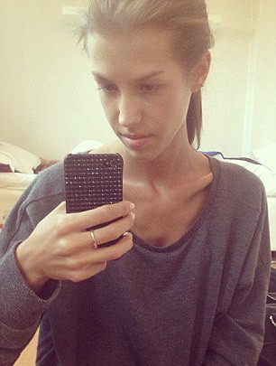 O tanara din Suedia a devenit un idol de urmat dupa ce a invins anorexia. Cum arata acum fata. VIDEO