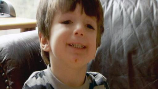 Boala bizara din cauza careia nu clipeste niciodata. Medicii nu-si pot explica starea baiatului